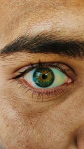 Recover Comfortably: Treating Corneal Abrasion at Home with Medical House Calls